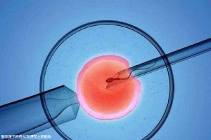 借卵代怀选性别